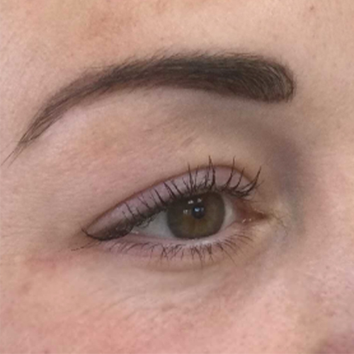 Na — Onderooglidcorrectie