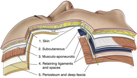 Deep Plane Facelift